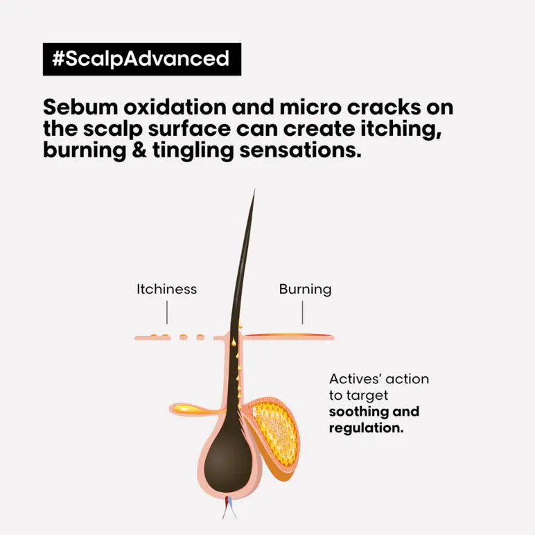 Scalp Advanced Anti-Discomfort Shampoo 300ml