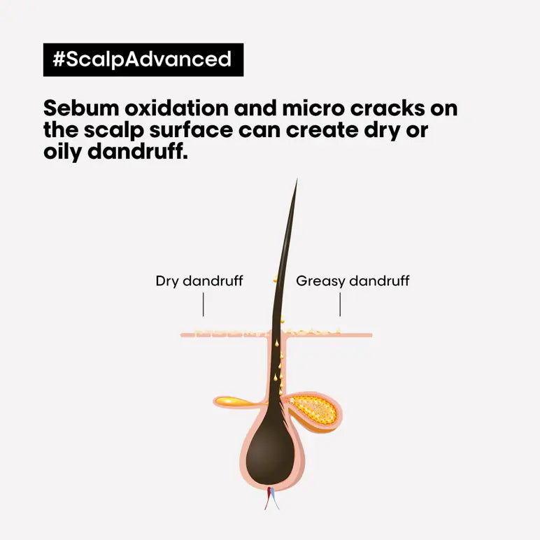 Scalp Advanced Anti-Dandruff Shampoo 300ml
